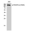 Western blot analysis of 293 cells using Phospho-PDGFR-α (Y849) Polyclonal Antibody STJ90601