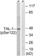 Western blot analysis of lysates from Jurkat cells treated with PMA 125 ng/ml for 30', using TAL-1 (Phospho-Ser122) STJ90638
