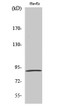Western blot analysis of various cells using Phospho-MSK1 (S376) Polyclonal Antibody diluted at 1:1000 STJ90677