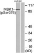 Western blot analysis of lysates from HUVEC cells treated with PMA 125 ng/ml for 30', using MSK1 (Phospho-Ser376) STJ90677