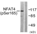 Western blot analysis of lysates from HeLa cells treated with Ca²⁺ 40 nM 30', using NFAT4 (Phospho-Ser165) Antibody. STJ90689