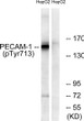 Western blot analysis of lysates from HepG2 cells, using PECAM-1 (Phospho-Tyr713) Antibody. The lane on the right was STJ90690