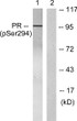Western blot analysis of lysates from 293 cells treated with Etoposide 25 μM 60', using Progesterone Receptor STJ90691