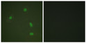 Immunofluorescence analysis of A549 cells using Progesterone Receptor (Phospho-Ser400) Antibody. The image on the right STJ90692