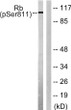 Western blot analysis of lysates from K562 cells, using Retinoblastoma (Phospho-Ser811) Antibody. The lane on the right STJ90699