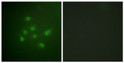 Immunofluorescence analysis of A549 cells using DAPK3 (Phospho-Thr265) Antibody. The picture on the right is blocked STJ90708