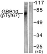 Western blot analysis of lysates from NIH/3T3 cells treated with Insulin 0.01U/ml 15', using GRB10 (Phospho-Tyr67) Antibody. The lane on the right is blocked with the phospho peptide.