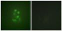 Immunofluorescence analysis of A549 cells using KIF2C (Phospho-Ser95) Antibody. The image on the right is blocked with STJ90726