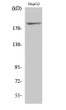 Western blot analysis of various cells using Phospho-IRS-1 (S312) polyclonal antibody diluted at 1:1000 STJ90731