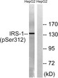 Western blot analysis of lysates from HepG2 cells, using IRS-1 (Phospho-Ser312) Antibody. The lane on the right was STJ90731