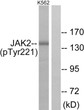 Western blot analysis of lysates from K562 cells, using JAK2 (Phospho-Tyr221) Antibody. The lane on the right is blocked with the phospho peptide. Western blot analysis of lysates from K562 cells, using JAK2 (Phospho-Tyr221) Antibody. The lane on the right is blocked with the phospho peptide.