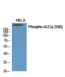 Western blot analysis of various cells using Phospho-ACC Alpha (S80) Polyclonal Antibody diluted at 1：1000