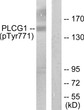 Western blot analysis of lysates from COS7 cells treated with EGF 200ng/ml 30', using PLCG1 (Phospho-Tyr771) Antibody. The lane on the right is blocked with the phospho peptide.