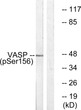 Western blot analysis of VASP (Phospho-Ser157) Antibody. The lane on the right is blocked with the VASP (Phospho-Ser157) peptide.