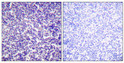 Immunohistochemical analysis of paraffin-embedded Human tonsil. Antibody was diluted at 1:100 (4°C overnight). High-pressure and temperature Tris-EDTA, pH8.0 was used for antigen retrieval. Negetive contrl (right) obtaned from antibody was pre-absorbed by immunogen peptide.