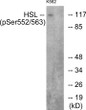 Western blot analysis of lysates from K562 cells, using HSL (Phospho-Ser552) Antibody. The lane on the right is blocked with the phospho peptide.