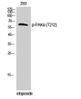 Western blot analysis of 293 cells using Phospho-PAK Alpha (T212) Polyclonal Antibody