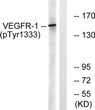 Western blot analysis of lysates from K562 cells treated with etoposide 25 µM 24 h, using VEGFR1 (Phospho-Tyr1333) STJ90838
