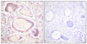 Immunohistochemistry analysis of paraffin-embedded human placenta, using Cyclin B1 (Phospho-Ser147) Antibody. The picture on the right is blocked with the phospho peptide.