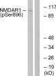 Western blot analysis of lysates from K562 cells treated with PMA 125ng/ml 30', using NMDAR1 (Phospho-Ser896) Antibody. The lane on the right is blocked with the phospho peptide. Western blot analysis of lysates from K562 cells treated with PMA 125ng/ml 30', using NMDAR1 (Phospho-Ser896) Antibody. The lane on the right is blocked with the phospho peptide.