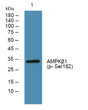 Western blot analysis of lysates from SH-SY5Y cells, primary antibody was diluted at 1:1000, 4°C overnight STJ90874