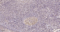 Immunohistochemical analysis of paraffin-embedded human tonsil. 1, Tris-EDTA, pH 9.0 was used for antigen retrieval. 2, STJ90874