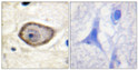 Immunohistochemistry analysis of paraffin-embedded human brain, using Coagulation Factor III (Phospho-Ser290) Antibody. The picture on the right is blocked with the phospho peptide.