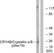 Western blot analysis of lysates from HepG2 cells treated with nocodazole 1ug/ml 16h, using CRYAB (Phospho-Ser19) Antibody. The lane on the right is blocked with the phospho peptide.
