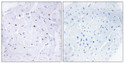 Immunohistochemistry analysis of paraffin-embedded human heart, using Smad3 (Phospho-Thr179) Antibody. The picture on the right is blocked with the phospho peptide.