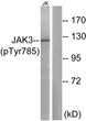 Western blot analysis of lysates from Jurkat cells, using JAK3 (Phospho-Tyr785) Antibody. The lane on the right is blocked with the phospho peptide.