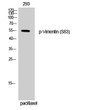 Western blot analysis of 293 cells using Phospho-Vimentin (S83) Polyclonal Antibody
