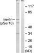 Western blot analysis of lysates from NIH/3T3 cells treated with IFN 2500U/ml 30', using Merlin (Phospho-Ser10) Antibody. The lane on the right is blocked with the phospho peptide.