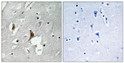 Immunohistochemistry analysis of paraffin-embedded human brain, using NMDAR2B (Phospho-Tyr1336) Antibody. The picture on the right is blocked with the phospho peptide.