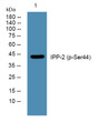 Western blot analysis of lysates from K562 cells, primary antibody was diluted at 1:1000, 4° overnight STJ90990