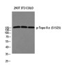 Western blot analysis of 293T 3T3 COLO using p-Topo II Alpha (S1525) antibody. Antibody was diluted at 1:1000