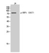 Western Blot analysis of JK cells using Phospho-DRP1 (S637) Polyclonal Antibody STJ91001