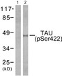 Western blot analysis of lysates from mouse brain, using Tau (Phospho-Ser422) Antibody. The lane on the left is blocked with the phospho peptide.