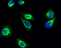 Immunofluorescence analysis of Hela cell. 1, Cortactin (phospho Tyr466) Polyclonal Antibody (green) was diluted at 1:200 (4°C overnight). 2, Goat Anti Rabbit Alexa Fluor 488 Catalog: (NA was diluted at 1:1000 (room temperature, 50min). 3 DAPI (blue) 10min.