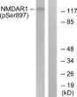 Western blot analysis of lysates from LOVO cells, using NMDAR1 (Phospho-Ser897) Antibody. The lane on the right is blocked with the phospho peptide.