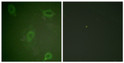 Immunofluorescence analysis of HeLa cells, using Amyloid beta A4 (Phospho-Thr743/668) Antibody. The picture on the right is blocked with the phospho peptide.