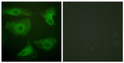 Immunofluorescence analysis of HeLa cells, using IkappaB-epsilon (Phospho-Ser22) Antibody. The picture on the right is blocked with the phospho peptide.