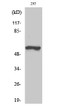 Western blot analysis of 293 cells using Phospho-TH (S19) Polyclonal Antibody diluted at 1：1000
