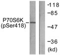 Western blot analysis of lysates from HT29 cells treated with serum 20% 15', using p70 S6 Kinase (Phospho-Ser418) Antibody. The lane on the right is blocked with the phospho peptide.