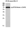 Western blot analysis of HT-29 serum 20% 15' using p-p70 S6 kinase Alpha (S418) antibody. Antibody was diluted at 1:1000