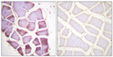 Immunohistochemistry analysis of paraffin-embedded human skeletal muscle, using S6 Ribosomal Protein (Phospho-Ser240) Antibody. The picture on the right is blocked with the phospho peptide.