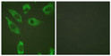 Immunofluorescence analysis of HeLa cells, using S6 Ribosomal Protein (Phospho-Ser240) Antibody. The picture on the right is blocked with the phospho peptide.