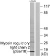 Western blot analysis of lysates from LOVO cells treated with H2O2 100 µM 30', using Myosin regulatory light chain 2 STJ91061