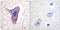 Immunohistochemistry analysis of paraffin-embedded human brain, using CD88/C5aR (Phospho-Ser338) Antibody. The picture on the right is blocked with the phospho peptide.