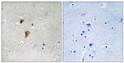 Immunohistochemistry analysis of paraffin-embedded human brain, using HSF1 (Phospho-Thr142) Antibody. The picture on the right is blocked with the phospho peptide.
