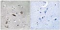 Immunohistochemistry analysis of paraffin-embedded human brain, using Doublecortin (Phospho-Ser376) Antibody. The picture on the right is blocked with the phospho peptide.